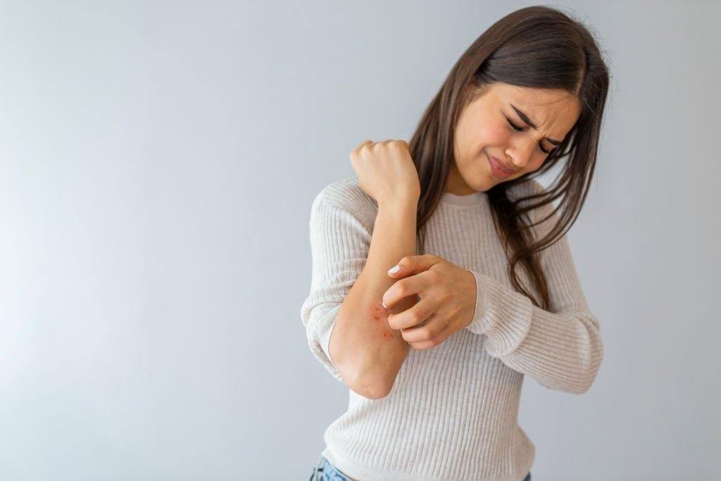 Eczema: symptoms, causes & treatment