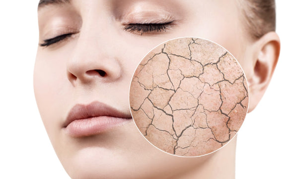 How to treat dry skin on the face: The ultimate guide